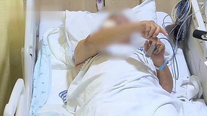  陈大伯|天气有多热？老伯摔了一跤，结果二级烫伤！医生的话让人心惊…