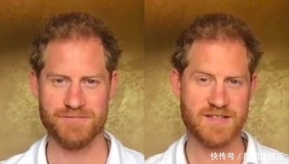 十足|哈里病了!被曝患“幽居症”,沧桑感十足像小老头,梅根这下慌了