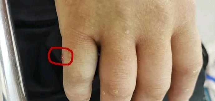  急诊|紧急提醒！醴陵急诊一个月接诊20多例，最近要格外注意