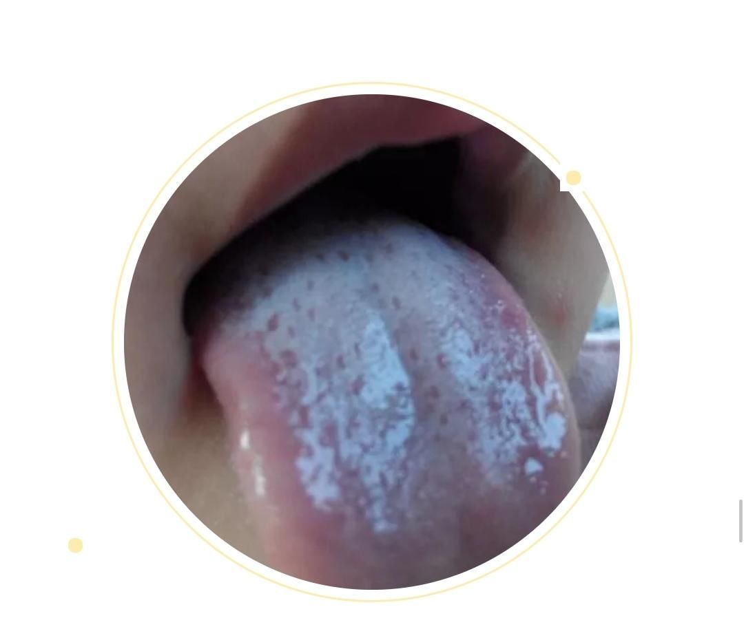  变化|身体健康情况怎么样？可以从舌头进行窥探