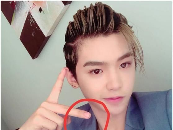  黄明昊|黄明昊拍写真时，有谁注意到他的手指，网友：让人心疼他