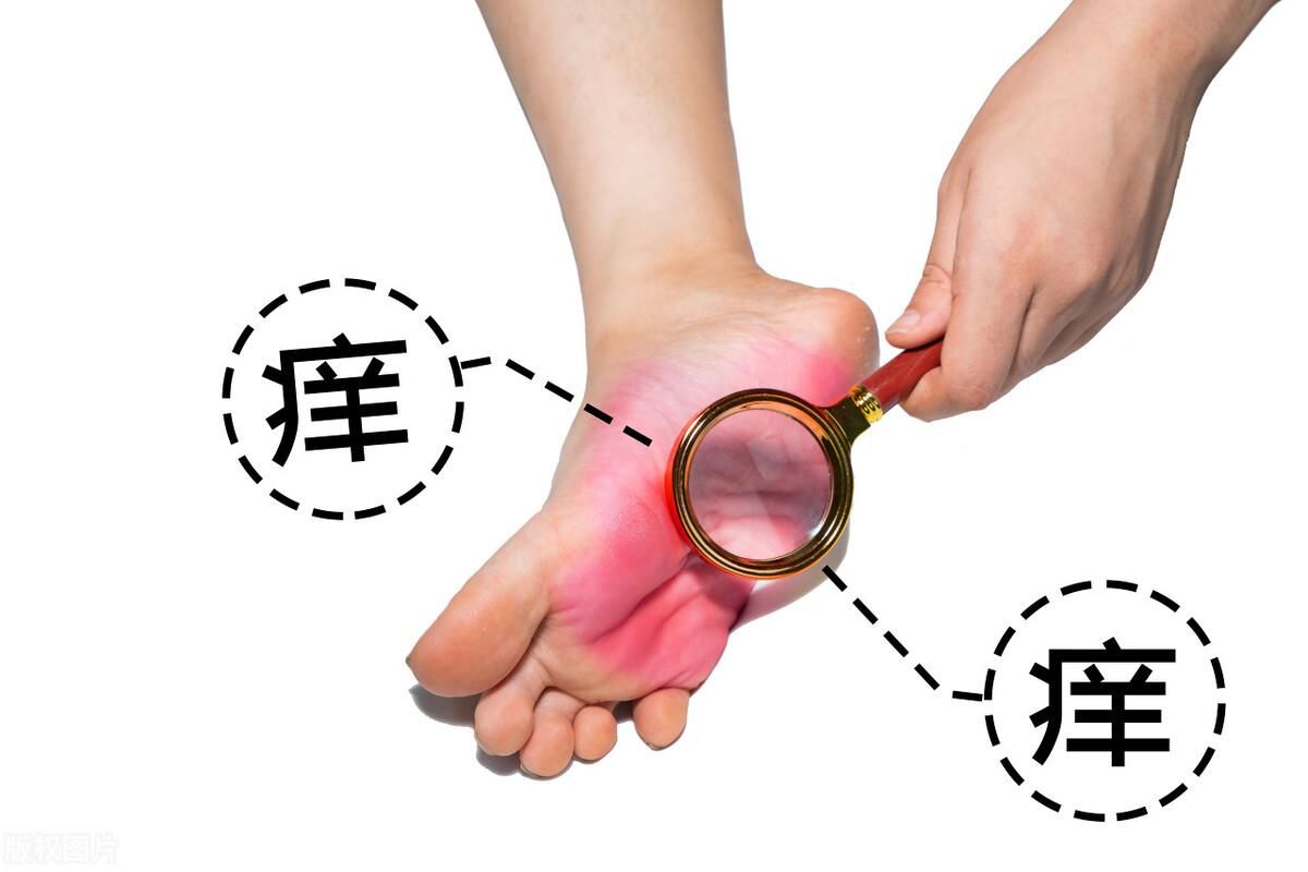 脚气怎么好得快不容易复发(脚气总是反反复复发作？用这3个处理办法，预防脚气不尴尬)