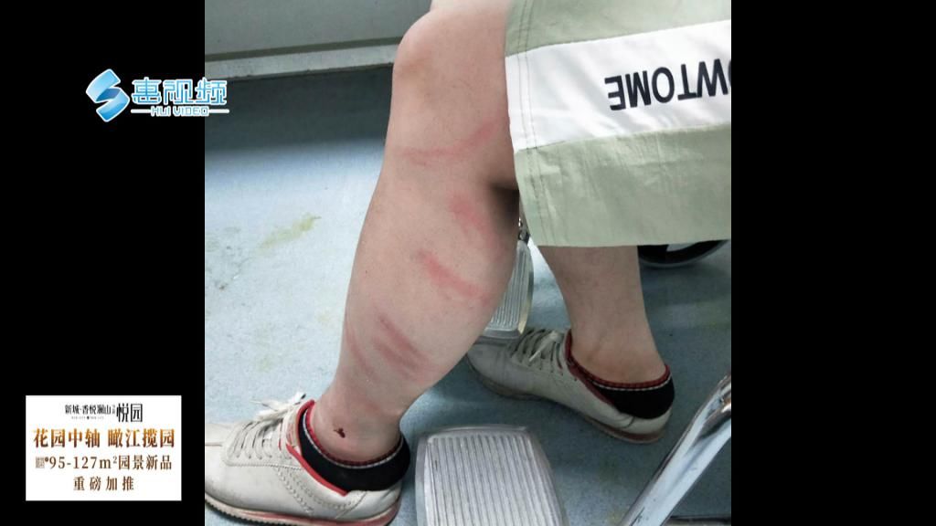 目击者|寻找目击者!滴滴司机半夜车被撞 还惨遭暴打