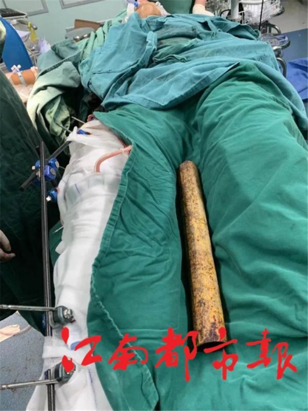  肢体|悲剧！小伙上个厕所，人差点没了！