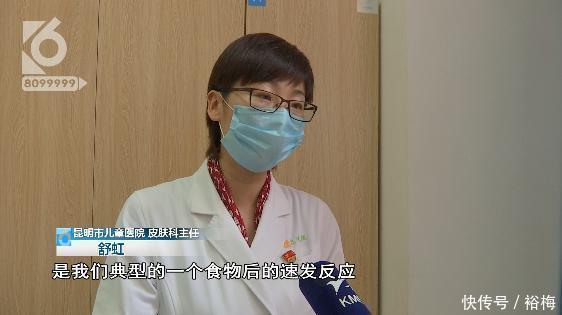  皮肤科主任|全网最性感“嘟嘟嘴”小朋友 背后原因却让更多家长害怕