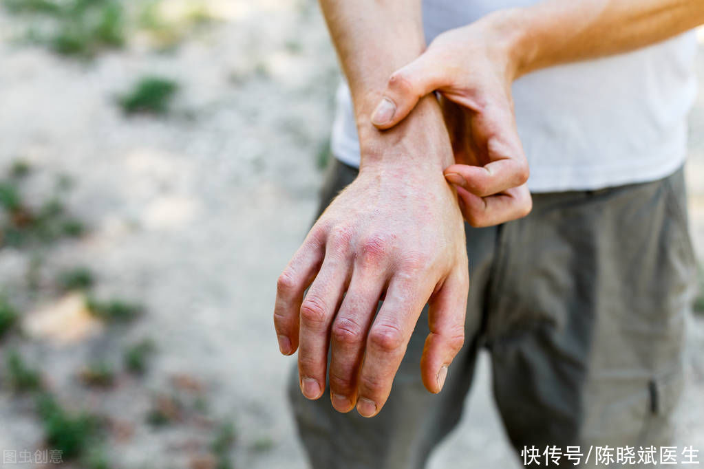皮肤出现这5个异样可能是肾衰竭(错把肾衰竭当成皮肤病！提醒：皮肤出现3个表现，或是肾脏在求救)