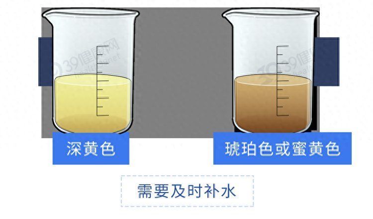 排尿很黄、异味很重？身体向你暗示了6件事，可能与疾病有关2023
