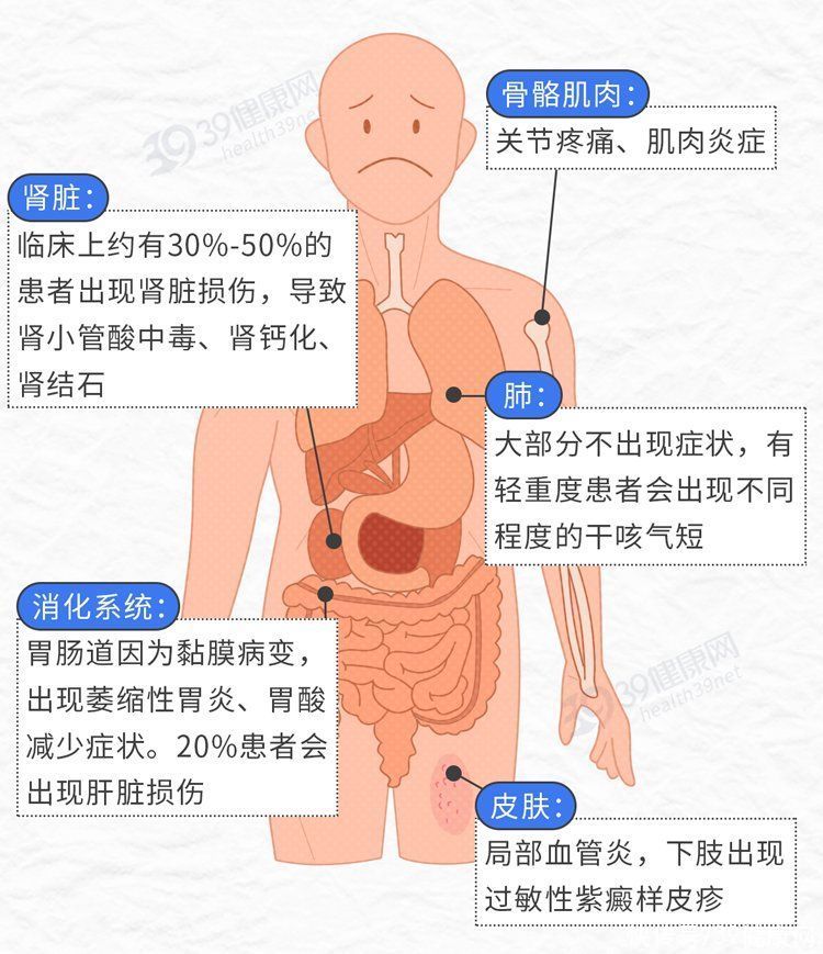 晚上睡觉起来口干舌燥是什么情况(晚上睡觉时突然口干舌燥？别以为是缺水了，或和这4个地方有关)