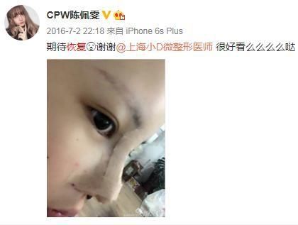  杜华|杜华儿子居然上过《变形计》！但这些重回农村的孩子更让人心痛…