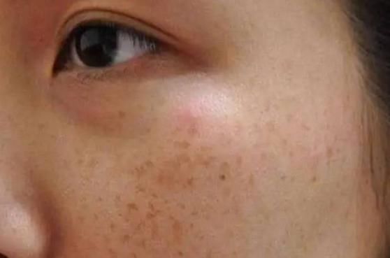 蚕宝宝们|小小桑叶,大有用途,坚持泡水喝,4大好处会让你“开心不已”