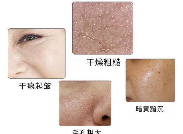 说了算|秘籍|空调房和干皮的兼容度,你说了算