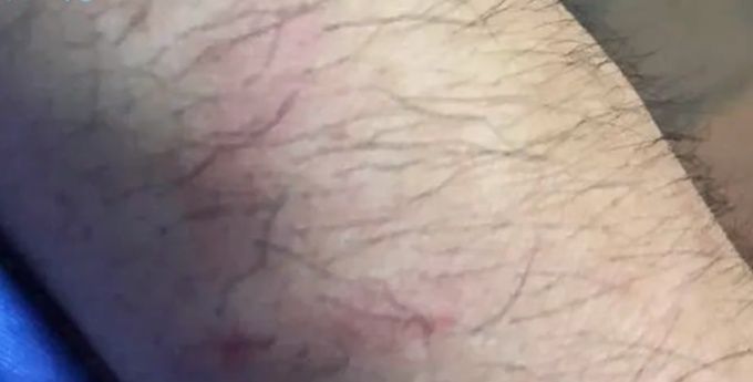 公交|女子带狗乘公交被拒后咬伤民警，已被行拘