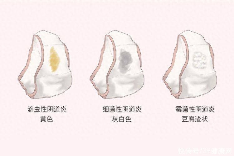 经常憋尿对阴道有什么好处(性生活前憋尿，会更刺激持久？办事时女性为何想尿尿？男女了解下)