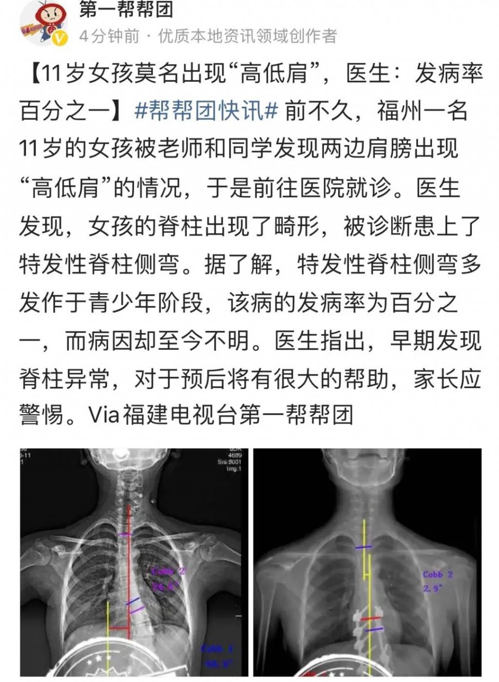 结局|帮帮日记 | 偷车贼被抓现行,半路“程咬金”令结局太舒适