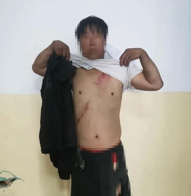  疲劳|【一盔一带】爱是一道伤 疲劳驾驶车辆侧翻桥下 安全带救了他一命