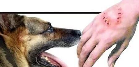 犬病毒|这种疾病是丧尸的原型,一旦发病死亡率近100%,该怎么预防?