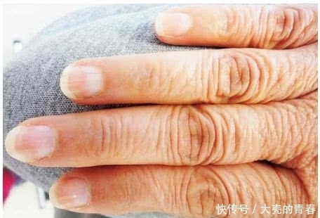  不好|肾不好，指甲知道？快对照着看看……