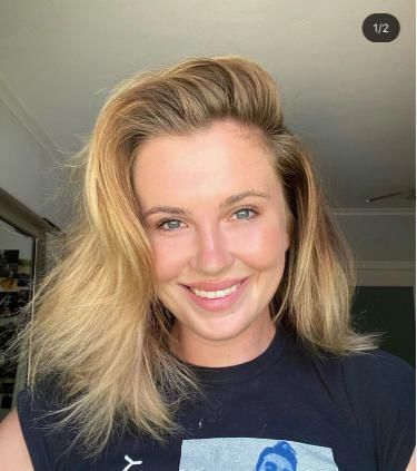 鲍德温|24岁超模在停车场遭袭击！面部被打淤青明显，钱财也被洗劫一空