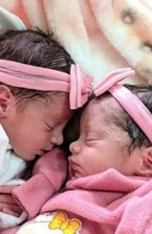  不料|夫妇参加聚会将17月大女儿留在卧室，不料孩子被宠物狗咬死