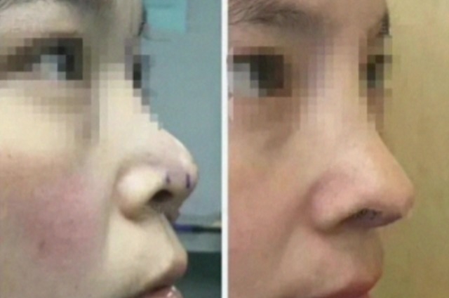  女主|甩了唐嫣老公，从小陶虹整成杨幂，却flop到接二手女主