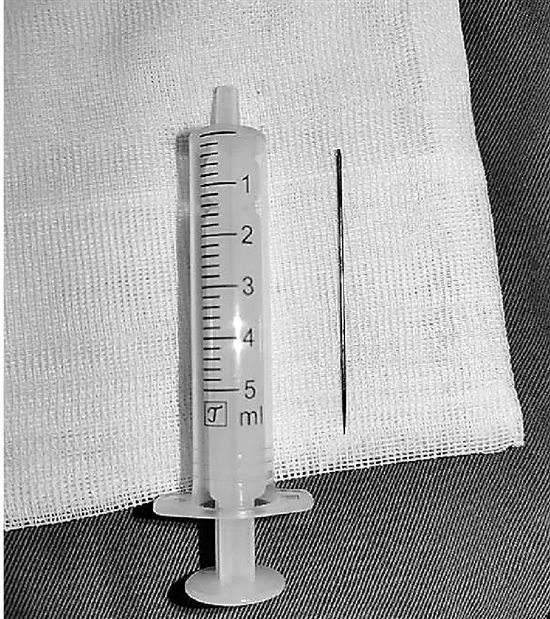 缝衣针|11岁小男孩将 6厘米长缝衣针放入尿道