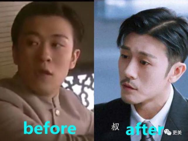  背靠|贵圈首个do成锥子脸的男星，背靠资本压番顶流小生，真宝藏