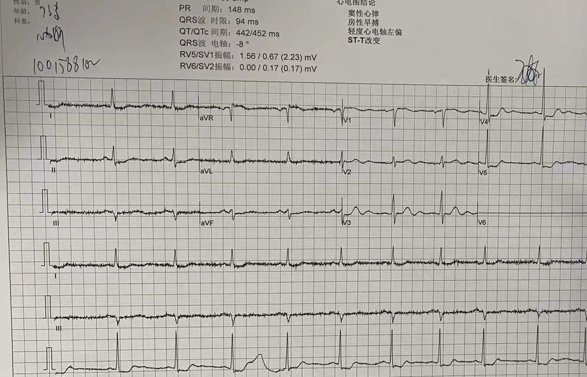 麻醉医生最害怕出现的情况(麻醉医生的一个“小心眼”，让患者避过了一场危机)