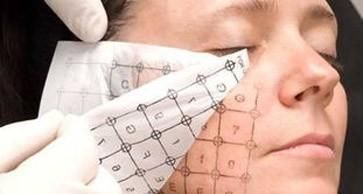  医生|皮肤科医生科普热玛吉——操作过程及患者问答，看完就不懵了