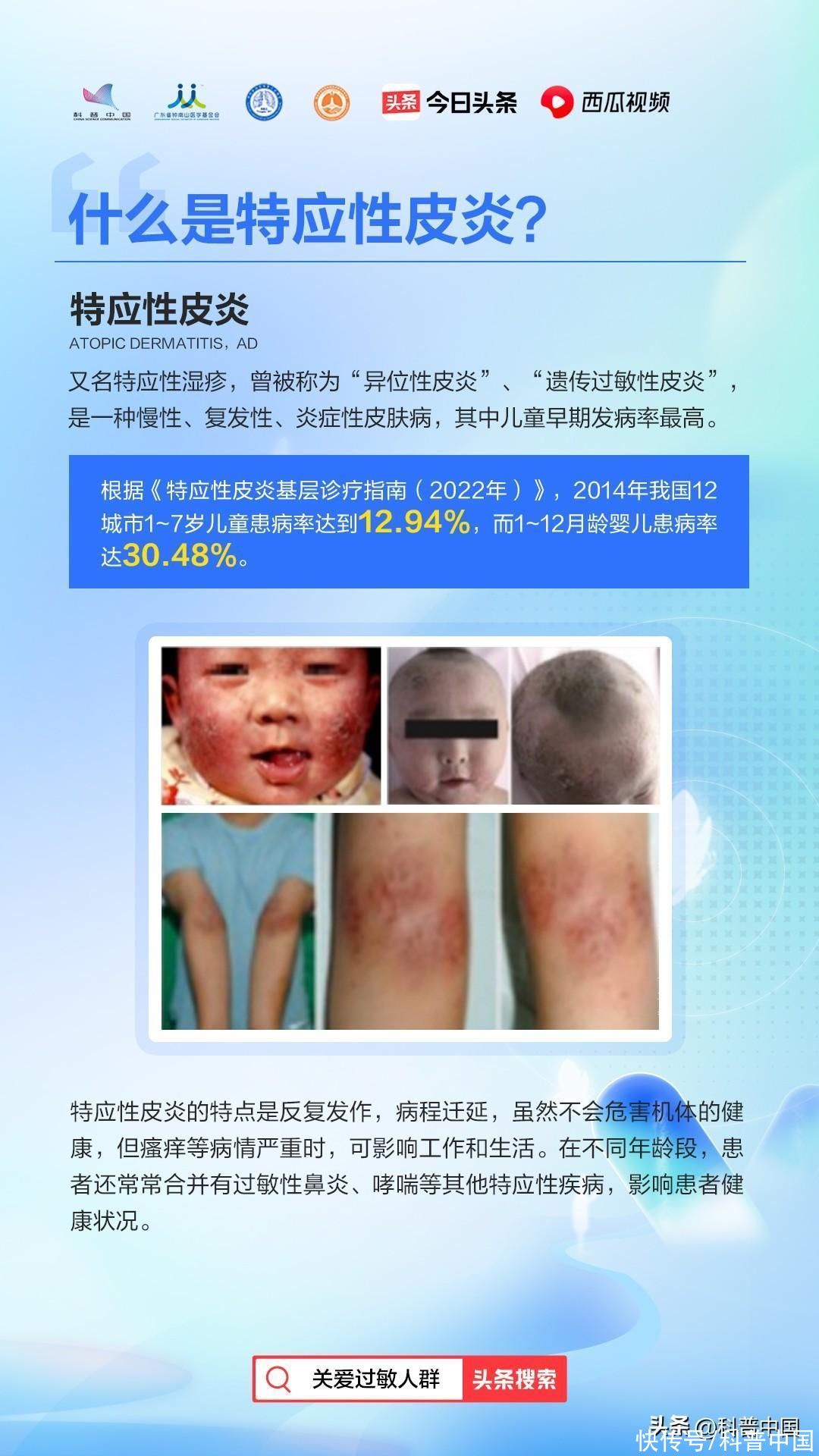 又痛又痒的皮肤病有哪些(又刺痒又难看 ！这种皮肤病到底该怎么办？)
