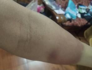 部位|怎样坚持拍打同一个部位一小时?