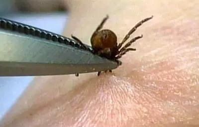  虫子|重要: 被咬一口致命, 这虫子随处可见, 干农活千万要注意