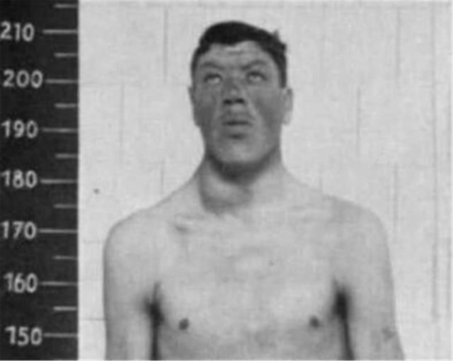 身高|国外男子前半生身高1.22米，后半生身高2.16米，全球只此一人