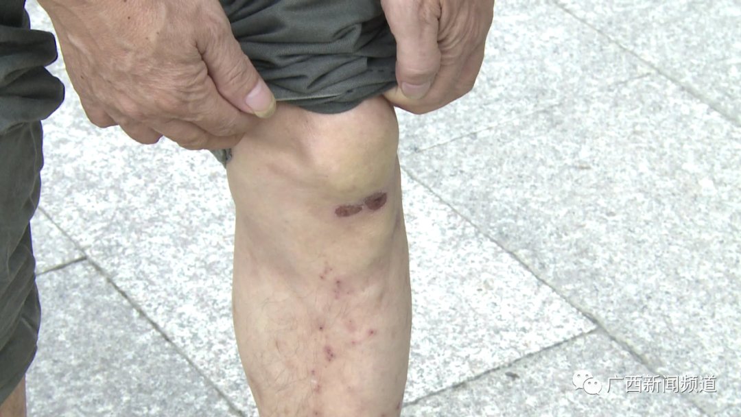 保安|“我爸是公安局副局长！”男子不肯挪车还狂殴57岁保安半小时，视频看气炸！结果一查…