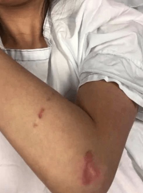 澳洲|澳洲两名女子群内聊新冠起争执 线下“约架”！当街互殴双双送医院