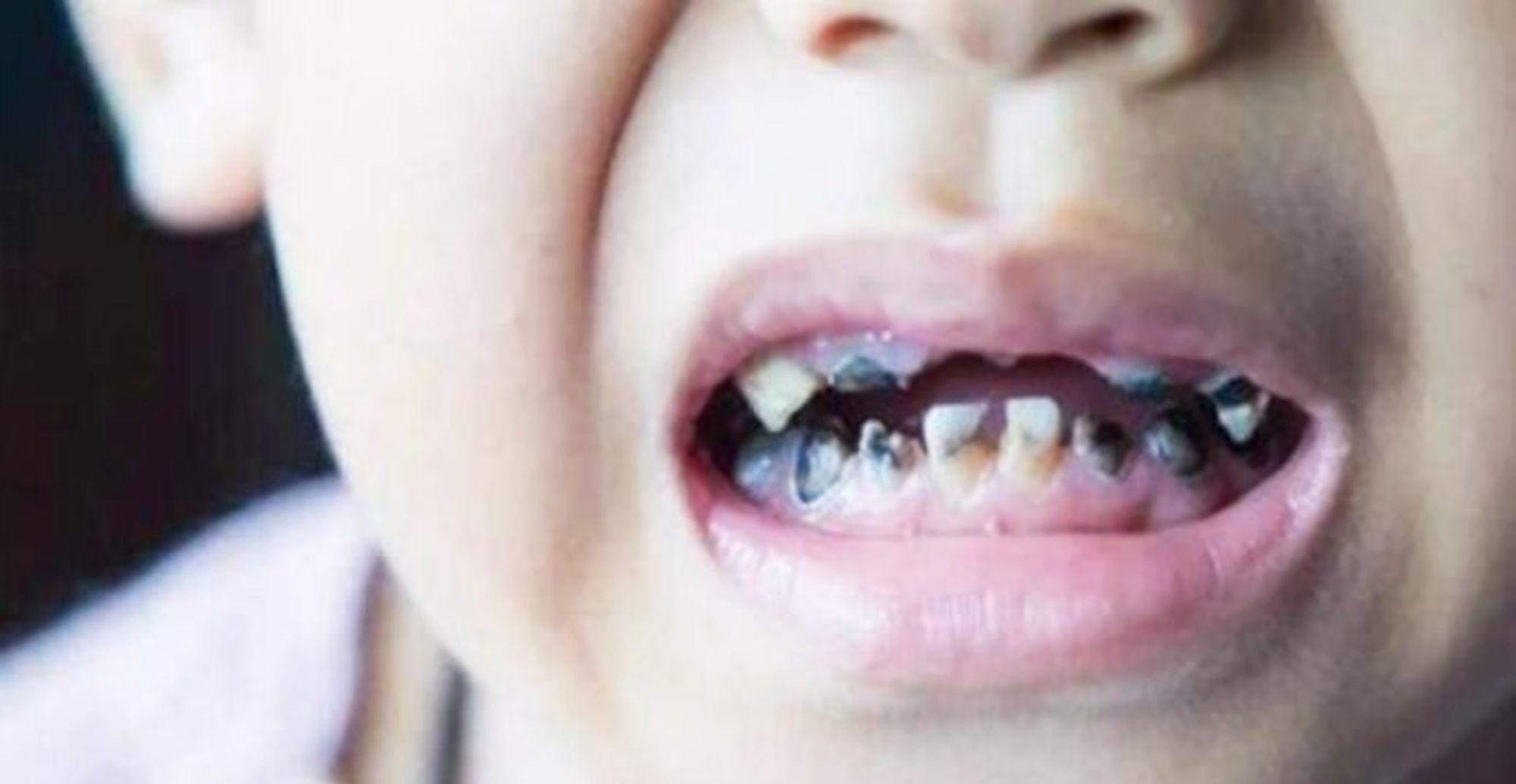  妈妈|孩子想吃糖的时候，妈妈该如何回答，特别是不同意的时候