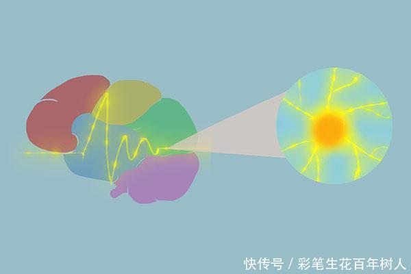 症状|脑梗发作跟什么有关发作症状是什么