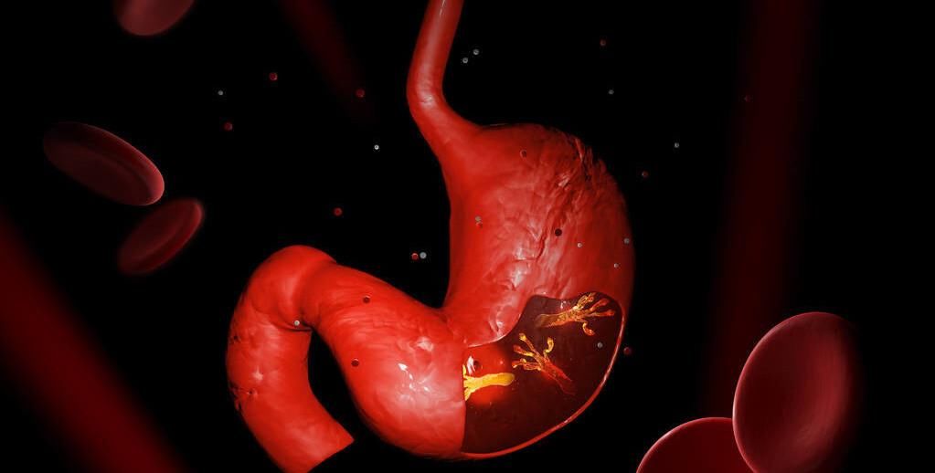  胃病|幽门螺杆菌“最怕”这5种药，医生：常喝口臭溜了，离胃病远远的