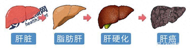 爬行和跑步哪个降血压效果好(运动降压“实锤”！英国研究：这种运动降血压最佳，不是跑步)