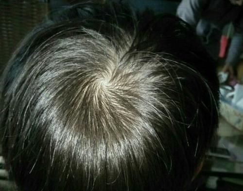 聪明|“一旋笨，二旋灵”究竟有没有道理？专家揭示真相，结果意想不到