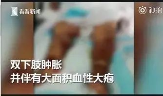 没命|螃蟹放倒一家三口，差点没命！吃蟹千万别犯这个错！