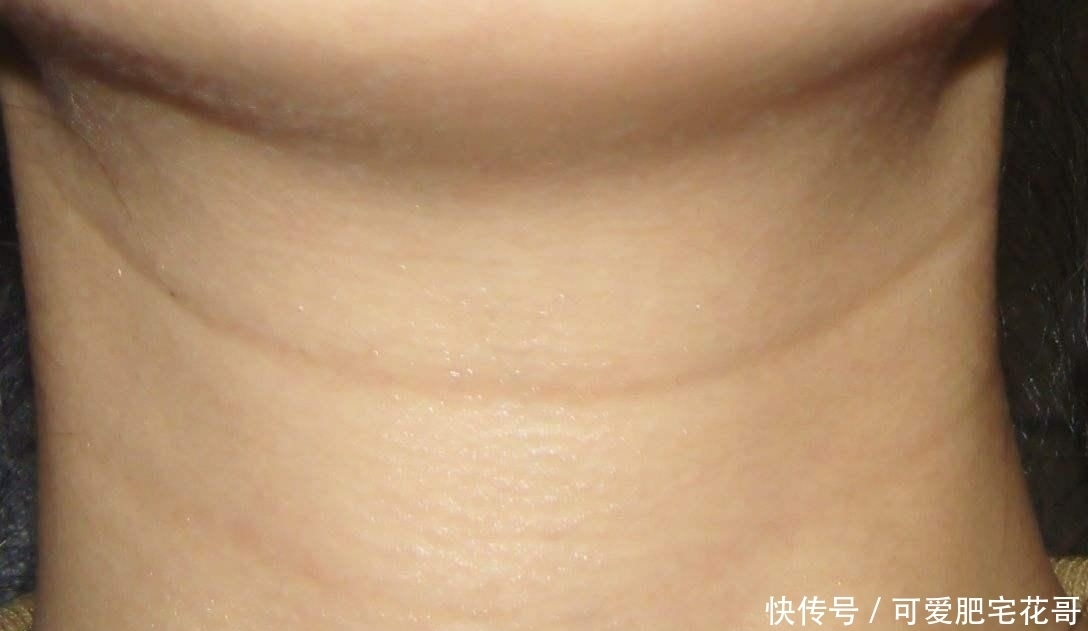 颈纹|脖子上的皱纹是怎么产生的?预防颈纹产生,你应该知道这些事