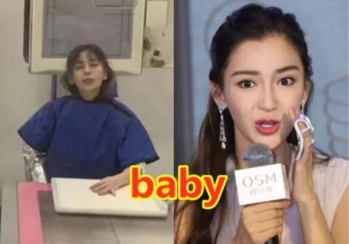  明星|明星录综艺时的意外，张艺兴晕倒，baby手指骨折，她被搭档摔成脑震荡！