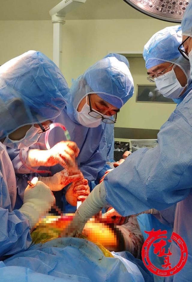 骨折|九旬200斤老太不慎摔骨折 术中透过10厘米脂肪层才见骨头