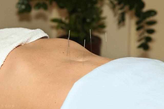 减肥|针灸减肥知多少?