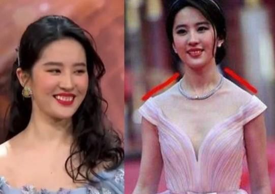 耳朵|明星也有身体缺陷，第三位不仔细看看不出来，最后一位在女人面前自卑！