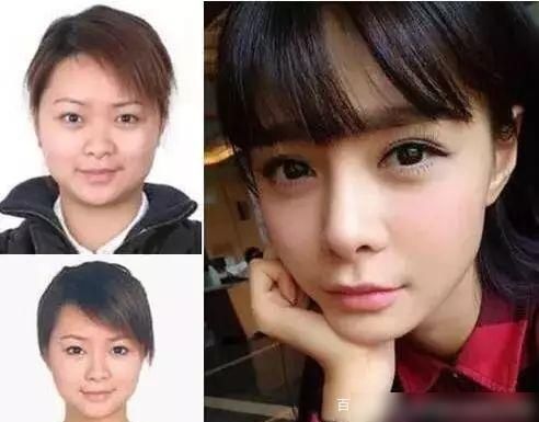  女团|整容手术和心理技能？女团能出来吗？