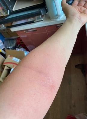 部位|怎样坚持拍打同一个部位一小时?