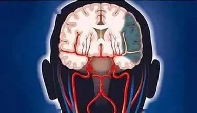  生命|把握黄金4.5小时，让这个威胁生命的疾病“化险为夷”