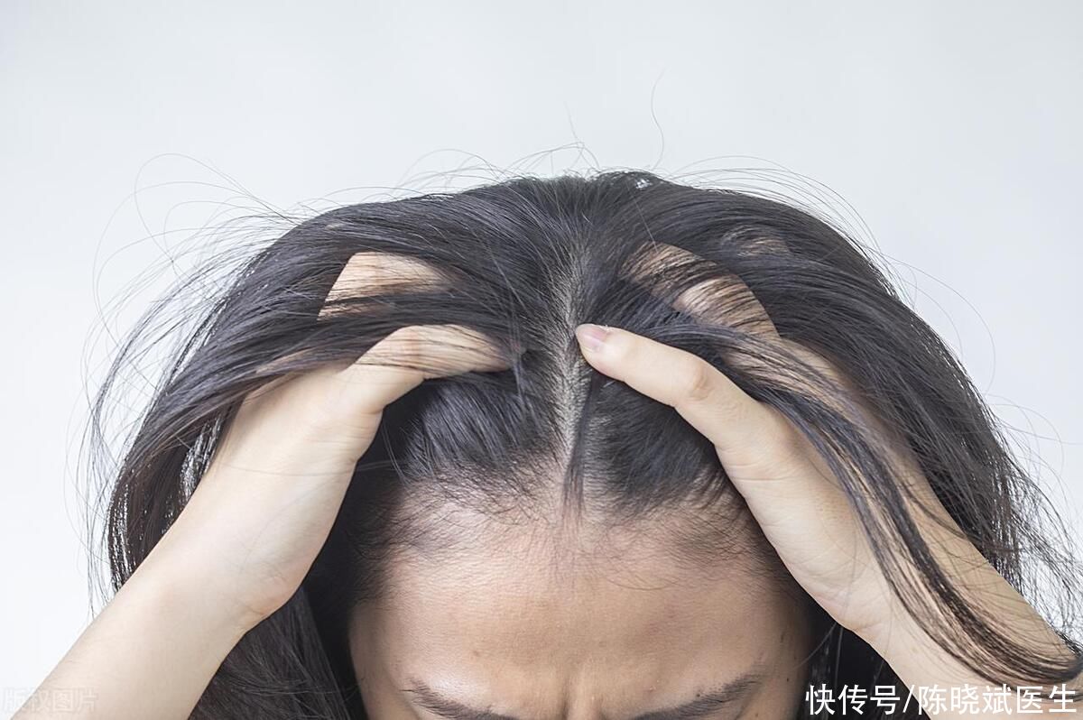 自身发色不黑偏黄是缺营养吗(发质变差，发色越来越黄？当心身体缺乏这4种营养素，别不当回事)