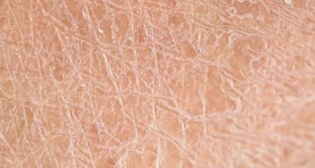 说了算|秘籍|空调房和干皮的兼容度,你说了算